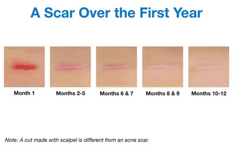 Do scars fade as you grow?