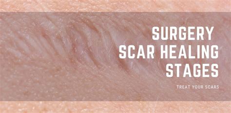 Do scars get darker as they heal?