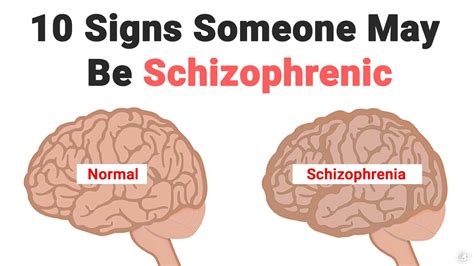 Do schizophrenics ever act normal?
