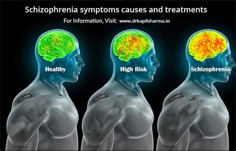 Do schizophrenics ever feel normal?