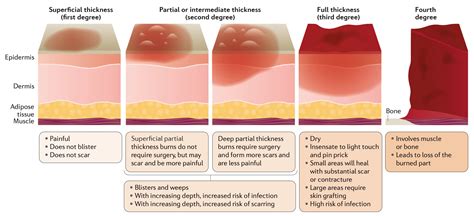 Do second degree burns bleed?