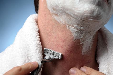 Do shaving spots go away?
