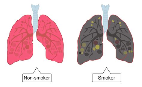 Do smokers have bigger lung capacity?