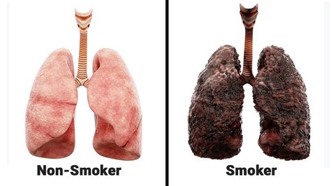 Do smokers lungs go back to normal?