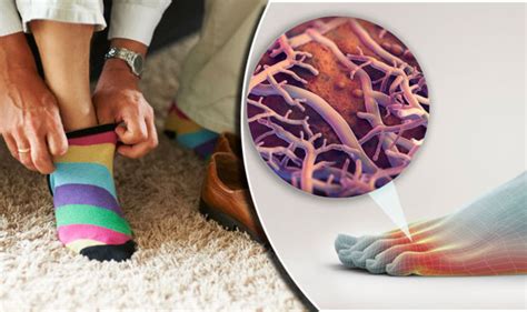 Do socks hold bacteria?