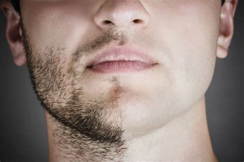 Do some people not have facial hair?