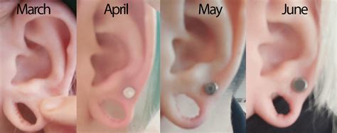 Do stretched ears ever heal?