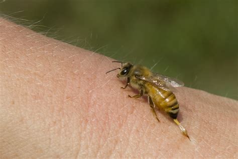 Do swarming bees sting?