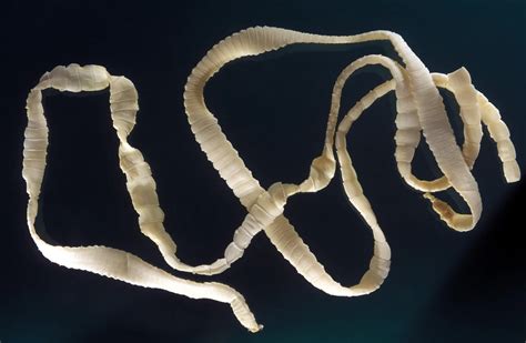Do tapeworms cause weight loss?