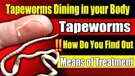 Do tapeworms crawl out?