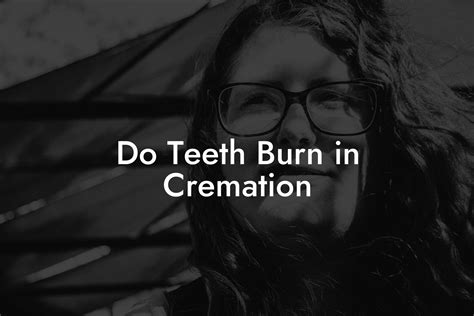 Do teeth burn in cremation?