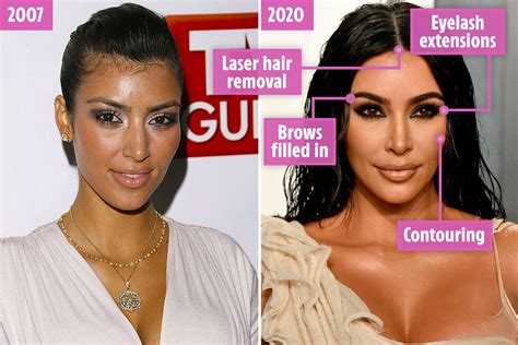 Do the Kardashians do Botox?