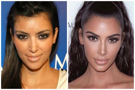 Do the Kardashians have breast implants?