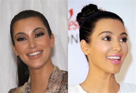 Do the Kardashians have real teeth?