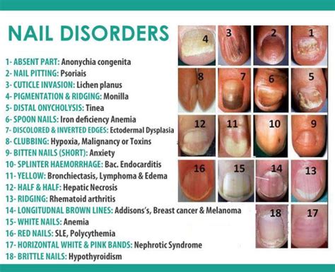 Do thyroid problems cause nail ridges?