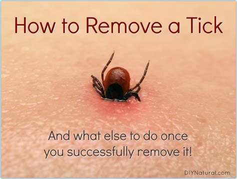 Do ticks hurt you?