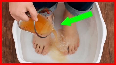 Do toxins come out of your feet?
