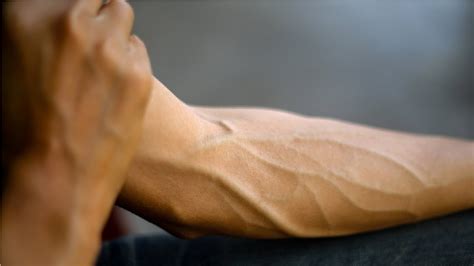 Do veins show more on skinny people?