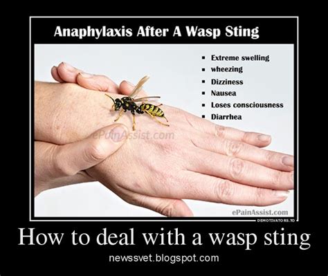Do wasp bites hurt?