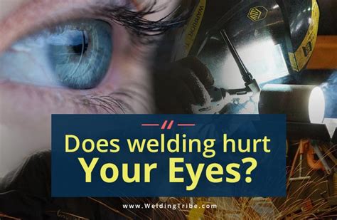 Do welders get bad eyes?