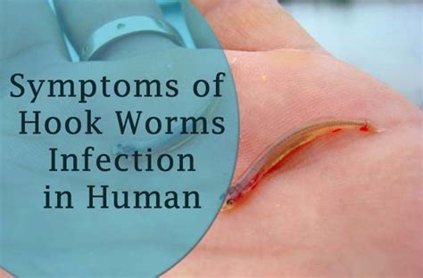 Do worms feel pain when hooked?