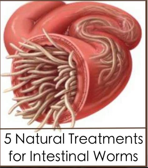 Do worms naturally go away?