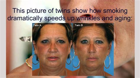 Do wrinkles from smoking go away?