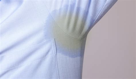 Do yellow stains go away?