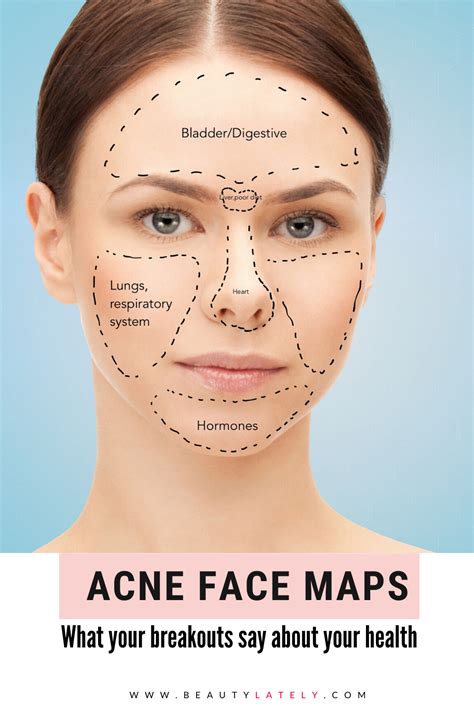 Do you age out of acne?
