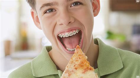 Do you eat pizza with braces?