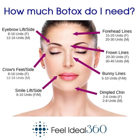 Do you have to get Botox forever?
