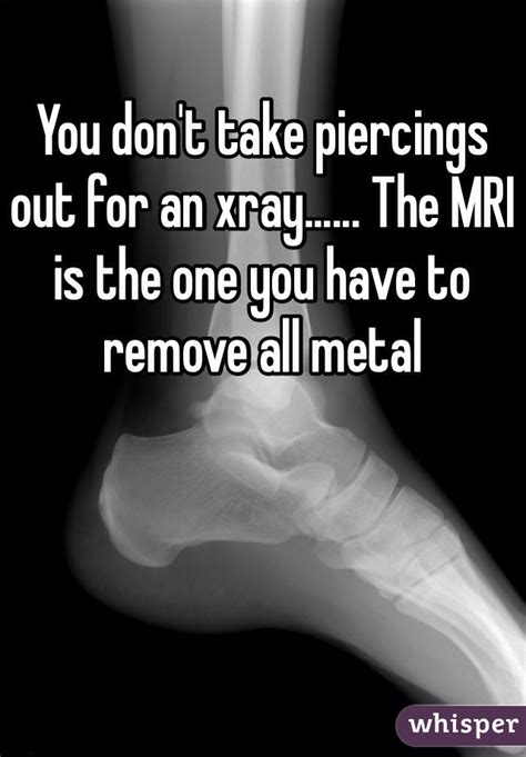 Do you have to take out piercings for an xray?