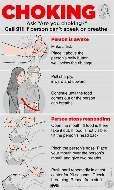 Do you need to go to hospital after Heimlich?