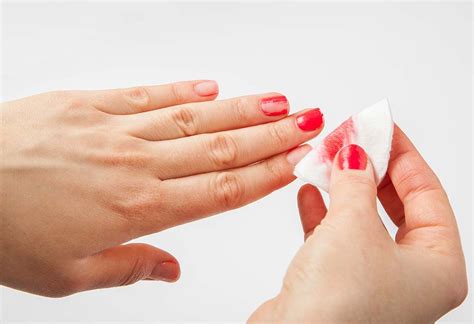 Do you need to remove nail polish before local anesthetic?