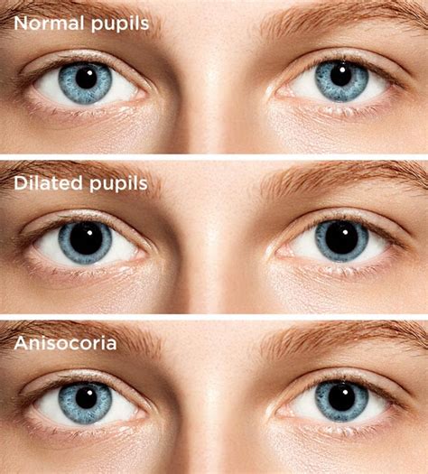 Do your pupils dilate when you cry?