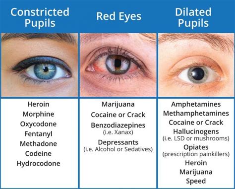 Do your pupils dilate when you drink alcohol?