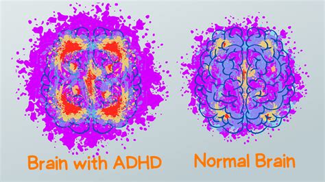 Does ADHD make your brain feel loud?