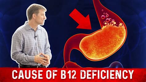 Does B12 cause gas?