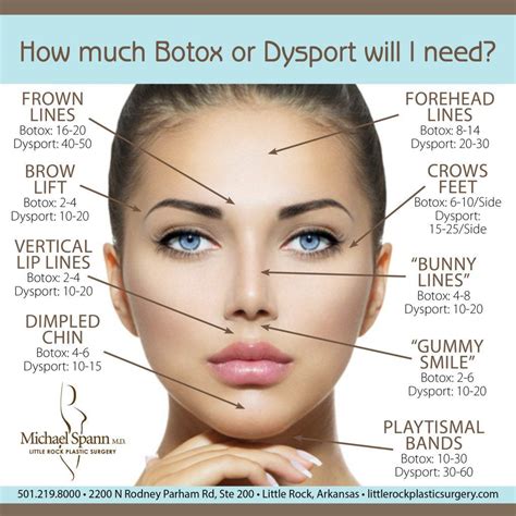 Does Botox once a year help?