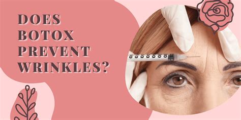 Does Botox prevent wrinkles later in life?