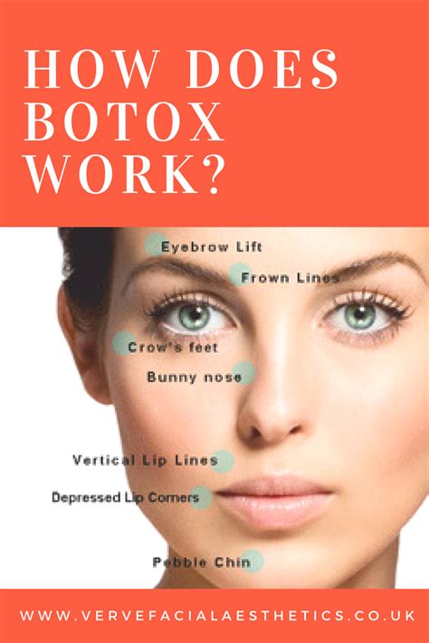 Does Botox work on very deep wrinkles?