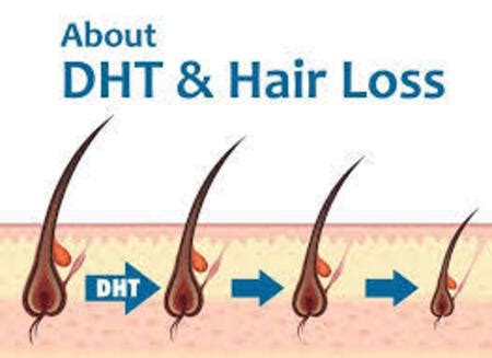 Does DHT make hair oily?