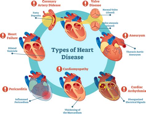 Does DMSO affect the heart?