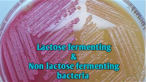 Does E. coli ferment lactose?