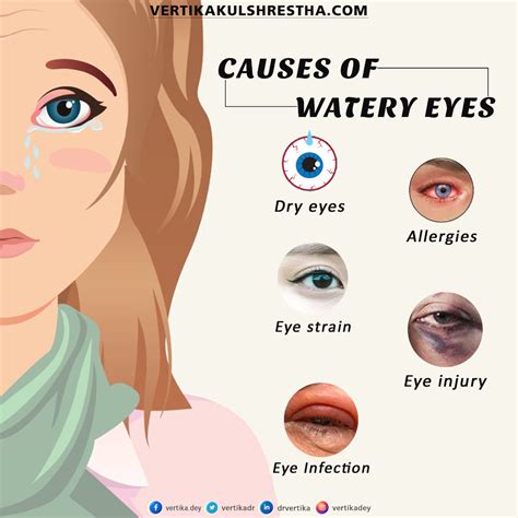 Does MS cause watery eyes?