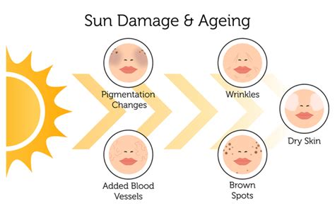 Does UV damage go away?