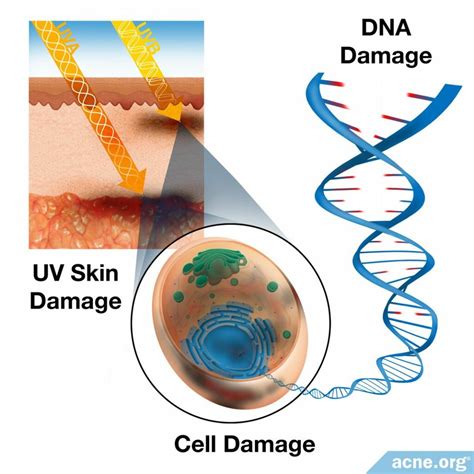 Does UVA cause sunburn?