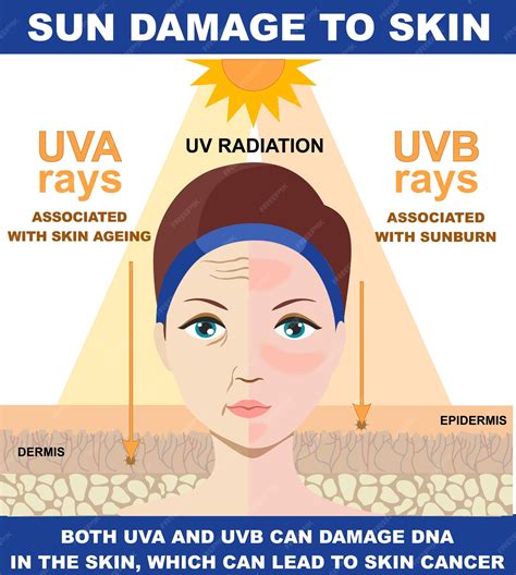 Does UVA or UVB cause sun damage?