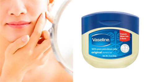 Does Vaseline clear acne?