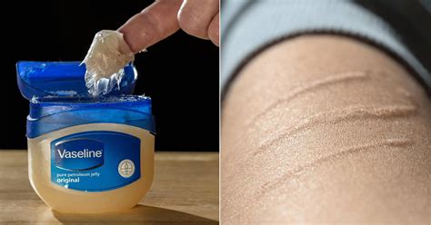 Does Vaseline fade white scars?